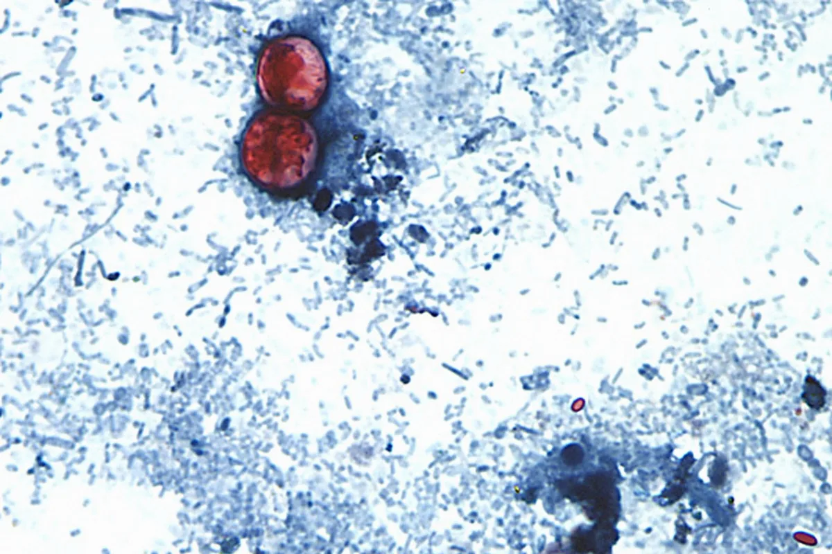 FDA Meksikas saimniecībā atrod parazītu, kas saistīts ar gandrīz 13 000 saslimšanu uzliesmojumu
