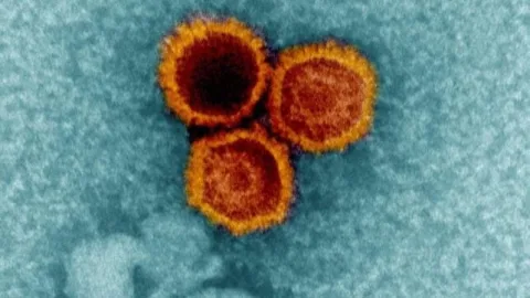 Three orange cells grouped together, surrounded by blue An electron micrograph showing Epstein-Barr virus particles. (NIAID)