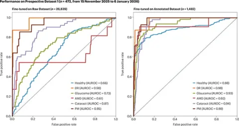 Eye examination accuracy False positives reduced significantly when expert-reviewed images were added to the training data. (Yan et al., Nat. Med., 2026)