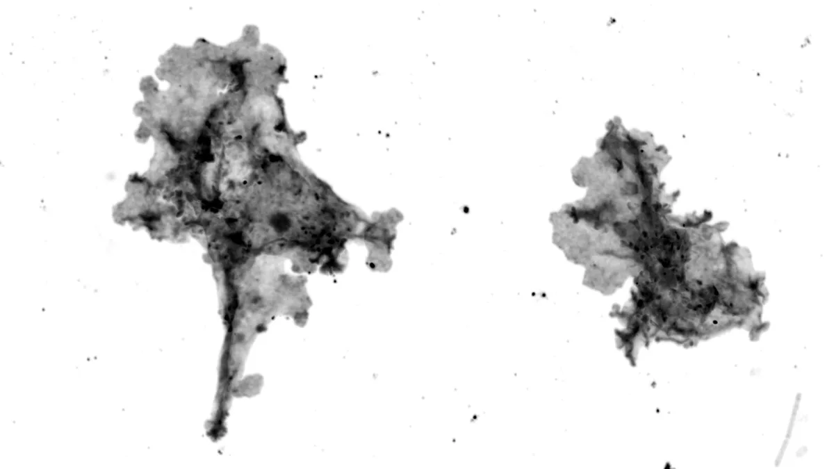 Image 37: A black and white image of two different amoebae on a clear background