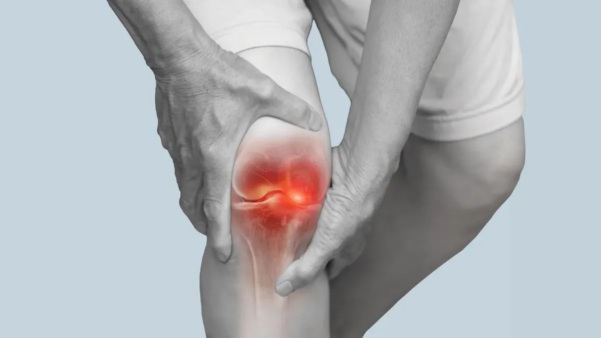 Personalizēta iešanas tehnika gada laikā mazināja ceļa osteoartrīta sāpes