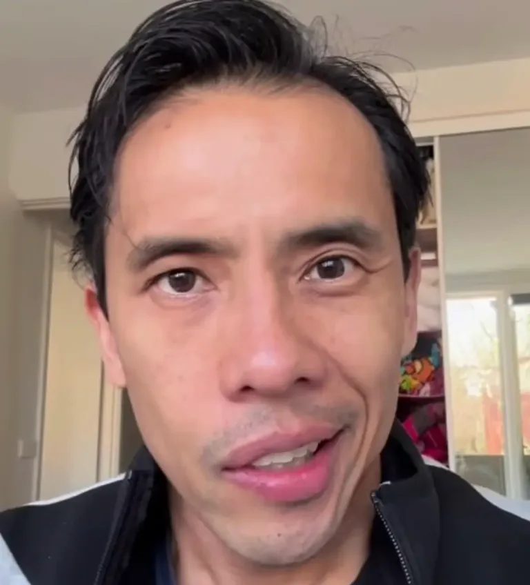 Image 5: He's since shared an update confirming he has Bell's palsy (Instagram/@iskraznews)