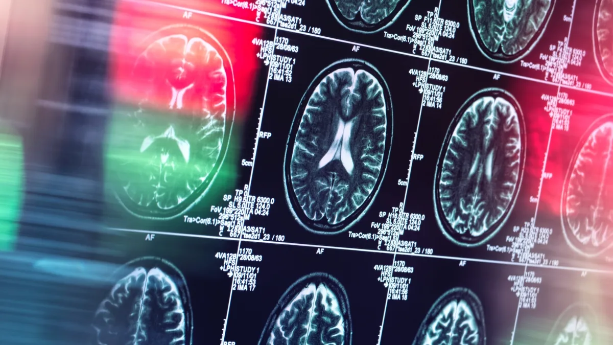 Alzheimer's Might Not Actually Be a Brain Disease, Reveals Expert An immune response from beyond the brain could end up attacking it, research suggests. (Westend61/Getty Images)
